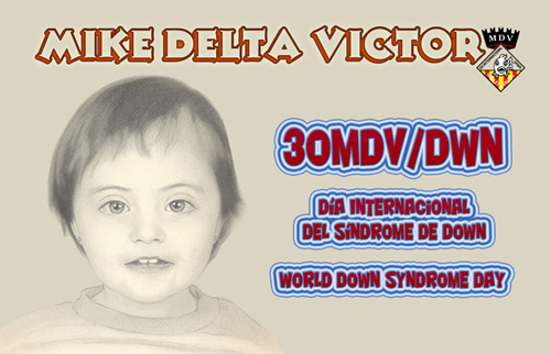 Qsl Sindrome de Down